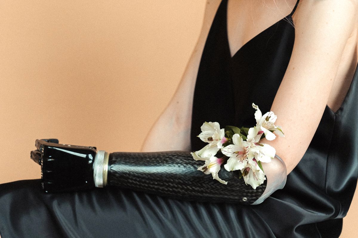 A person in a black thin-strap dress holds white flowers across a prosthetic forearm.
